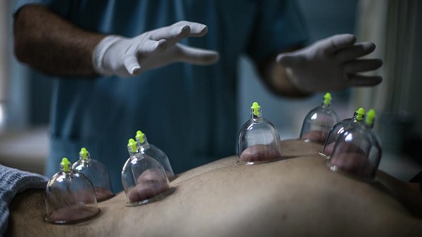 Hacamat nedir? Hacamat nasıl yapılır?