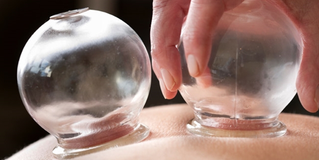 Hacamat migreni tedavi ediyor!