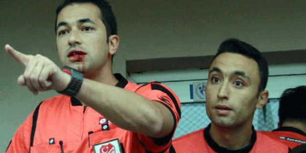 Hakeme kafa atıp, dudağını patlattı