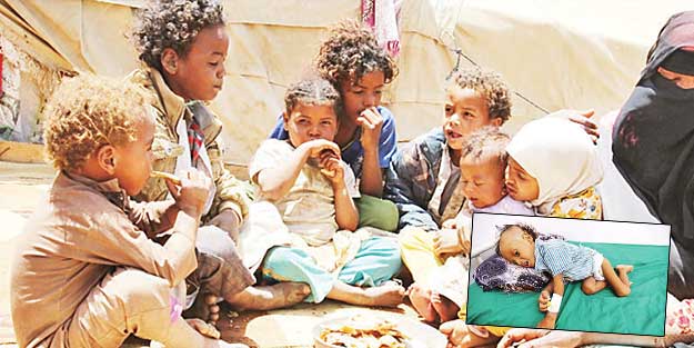 Halkın yüzde 80’i aç! Yemen kuru ekmeğe muhtaç