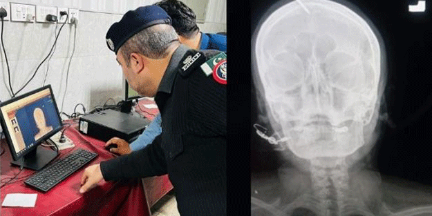 Hamile kadın erkek çocuğu olsun diye başına çivi çaktırdı