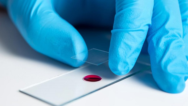 Hangi kan grubu koronavirüsten daha çok etkileniyor?