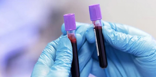 Hangi kan grubunda olanlar daha uzun yaşıyor? Araştırmayla ortaya çıkan gerçek: uzmanlar şaşkın!