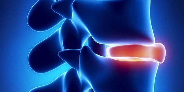 Hanımlar kendinizi fıtık etmeyin