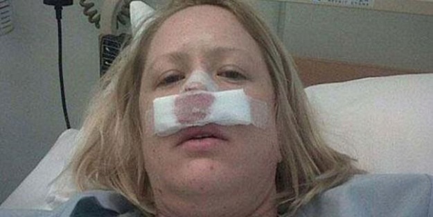 Hapşırdı burnu elinde kaldı!