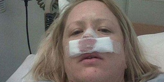 Hapşırdı burnu elinde kaldı!