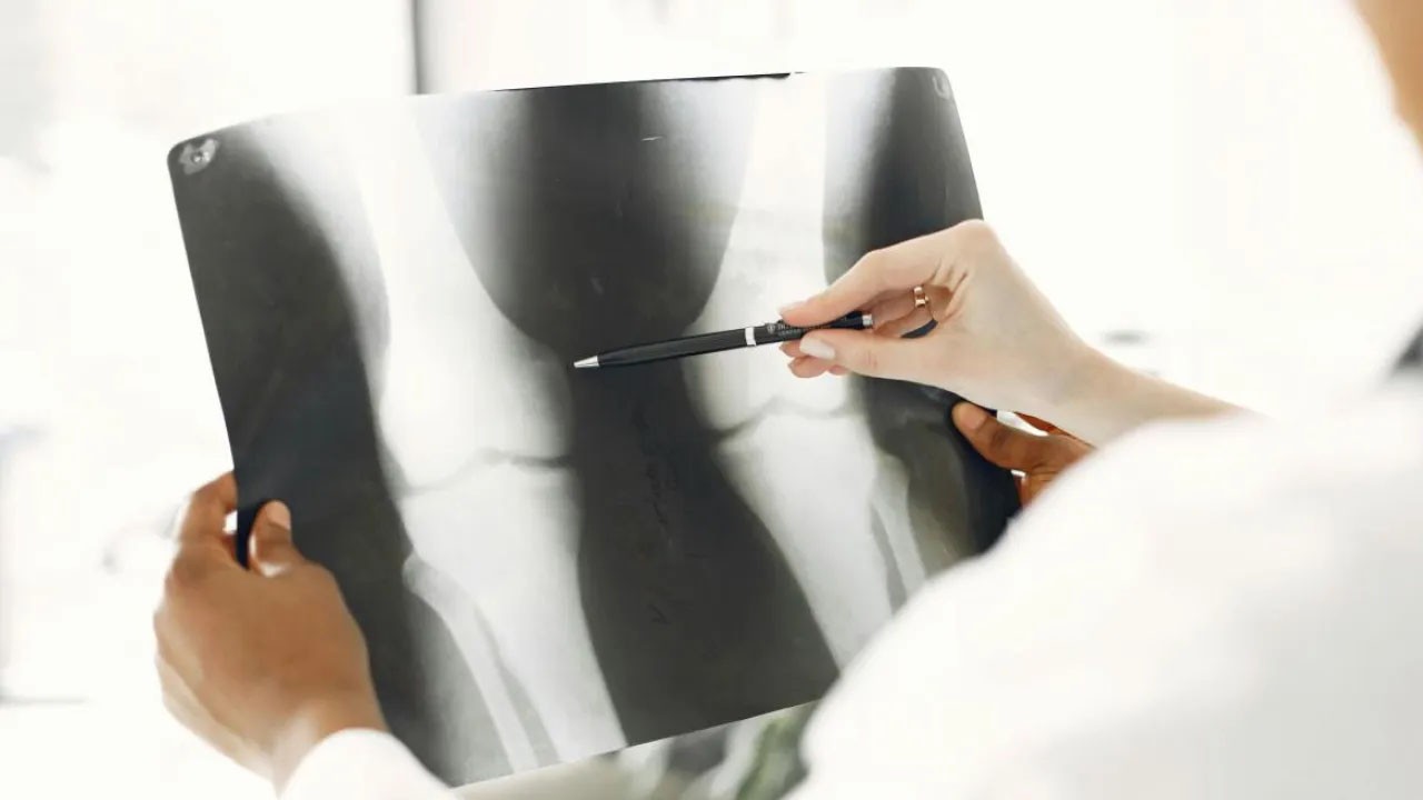 Hasarlı kemiği Işığa maruz kalınca iyileştiriyor