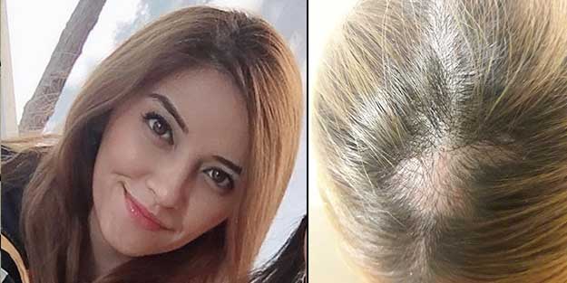 Hasta yakını, sağlık çalışanının saçlarını kökünden kopardı!