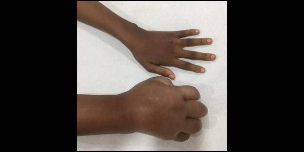 Hastalığının çaresini Türkiye'de buldu