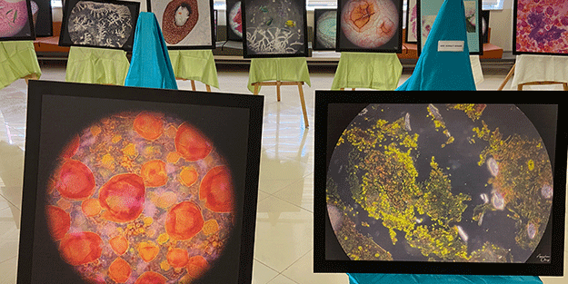 Hastalıklı dokular sanat eserine dönüştü