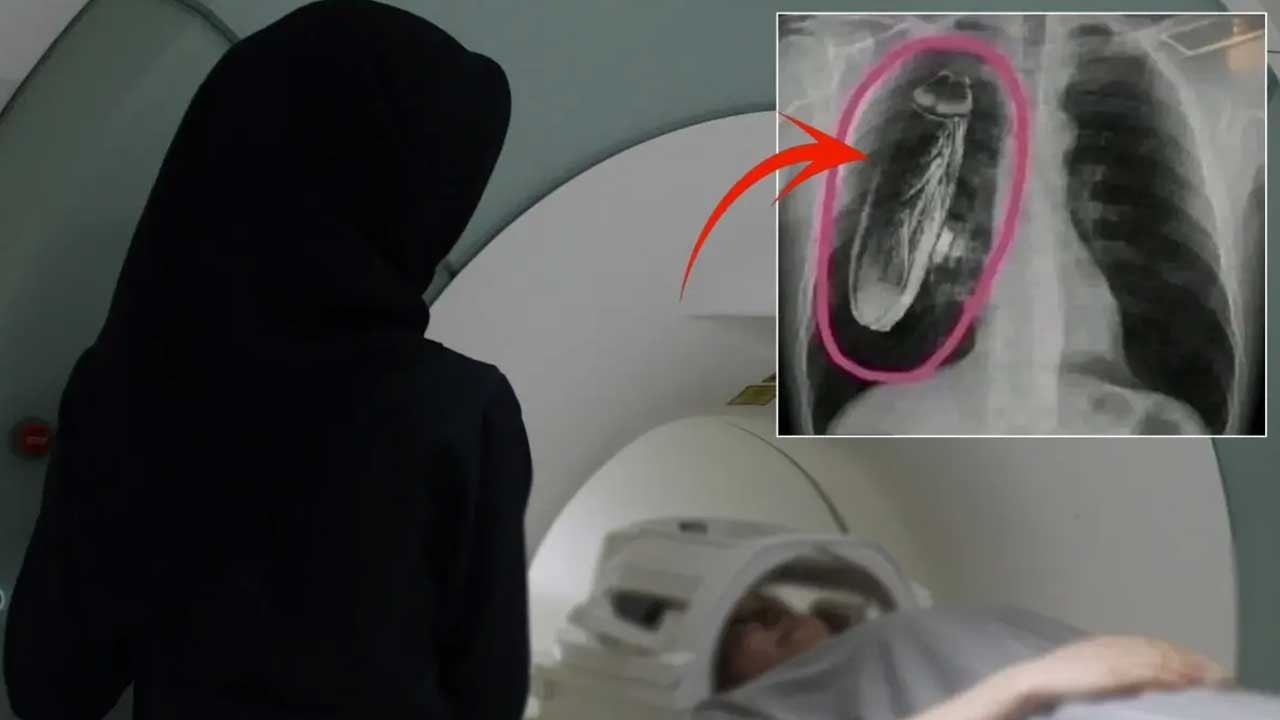 Hastanede mide bulandıran olay