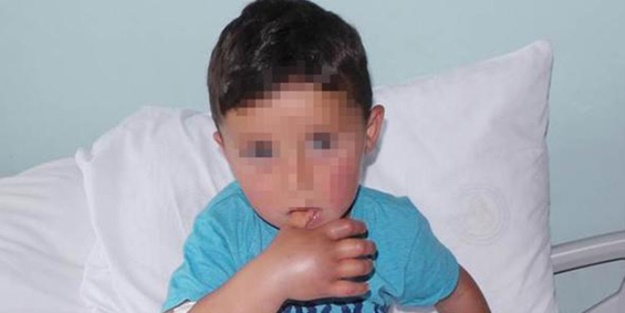 Hastanede yılan ısırdı!