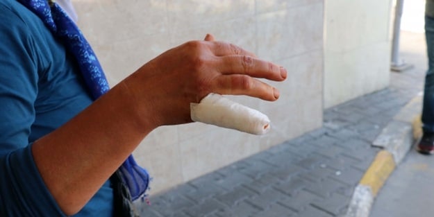 Hastanelerin acillerinde acemi kasap yoğunluğu