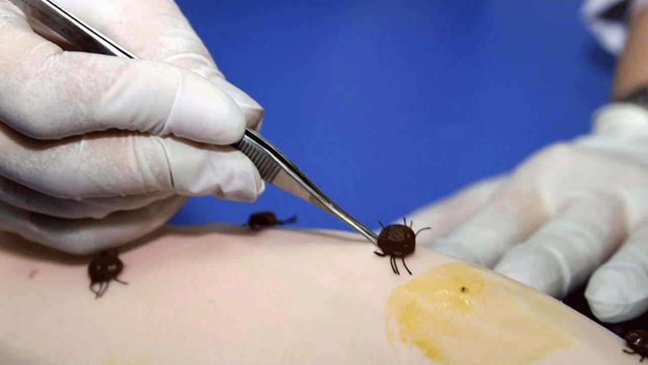 Havalar ısındı kabus başladı: Isırılan 8 kişiden 1'i hayatını kaybetti, 2’si yoğun bakımda yaşam savaşı veriyor