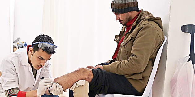 Hayata protez bacakla adım atıyorlar