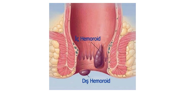 Hayatı zehreden büyük azaba son