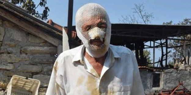 Hayvan sevgisi bu hale getirdi