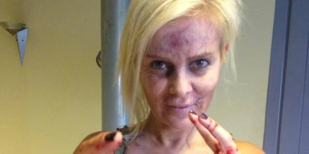 Hayvanseverler önce Ömür Gedik’i yer!