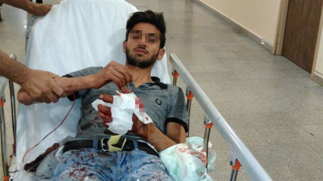 Hazırladığı EYP elinde patladı