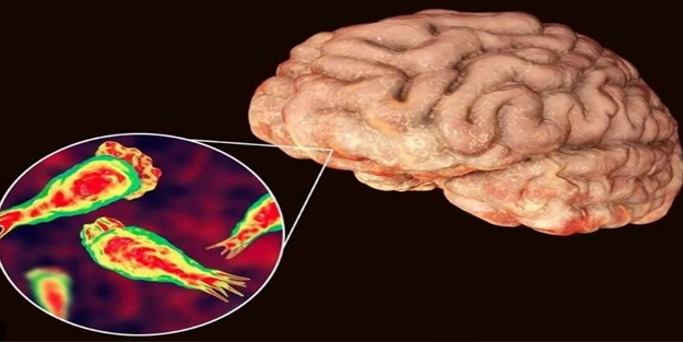 Helak oluyorlar! İsrail'de beyin yiyen amip paniği!