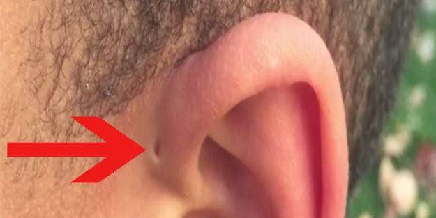 Hemen kontrol edin, sizde de bu küçük delikten olabilir!