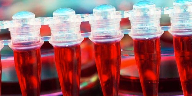 Hemofili nedir belirtileri neler? Hemofili nasıl tedavi edilir