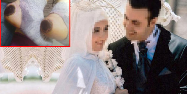Hemşireler doğumdan çıkan annenin ayaklarını yaktı! Cezaları belli oldu