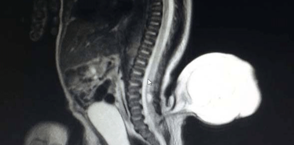 Henüz anne karnındayken tespit edildi… Doktorlar ne olduğunu açıklayınca…