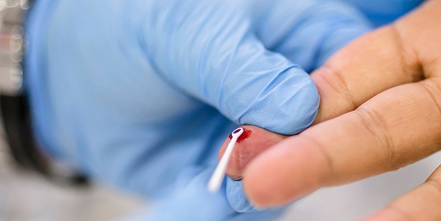  Hepatit A salgınına dikkat!