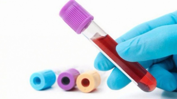 Hepatit B yakında tarihe karışabilir