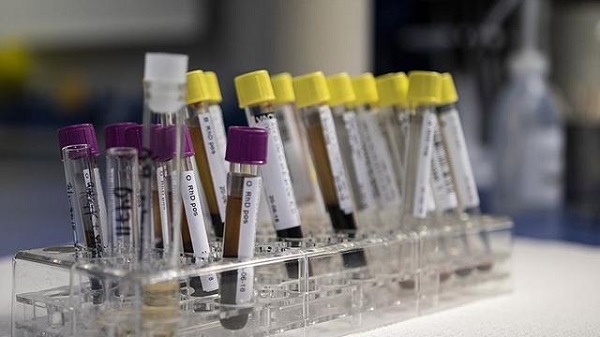 Hepatit nedir? Gizemli hepatit virüsü belirtileri nedir?