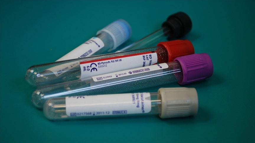 Hepatit virüsüne sahip her 10 kişiden 9'u hastalığından habersiz