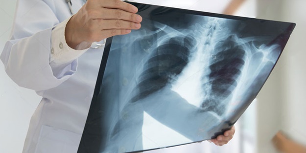 Hepsi birbirinden korkunç! Doktorları bile şaşkına çeviren görüntüler