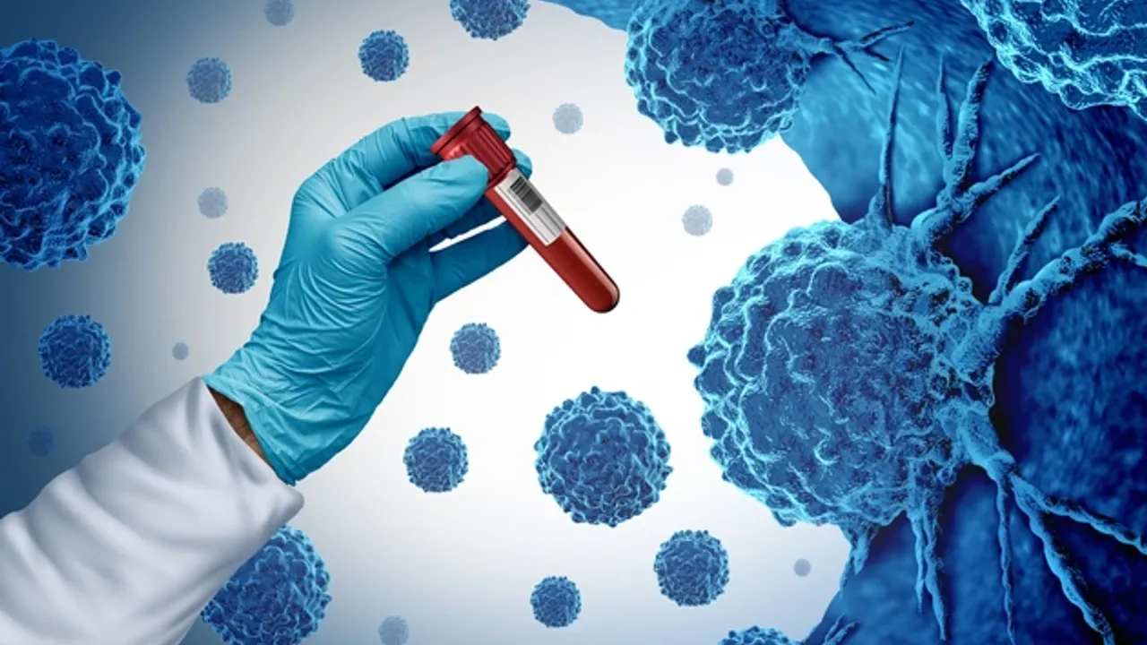 Her Dört Kanser Vakasından Biri Aslında Engellenebilir!