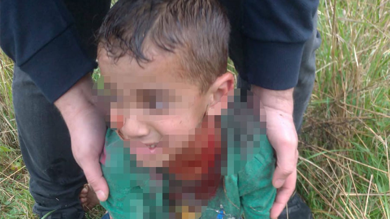 Her geçen gün sorun büyüyor! Başıboş köpekler 5 yaşındaki çocuğu ağır yaraladı