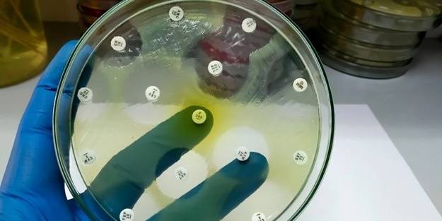 Her gün binlerce kişiyi öldürdü! İkaz ettiler