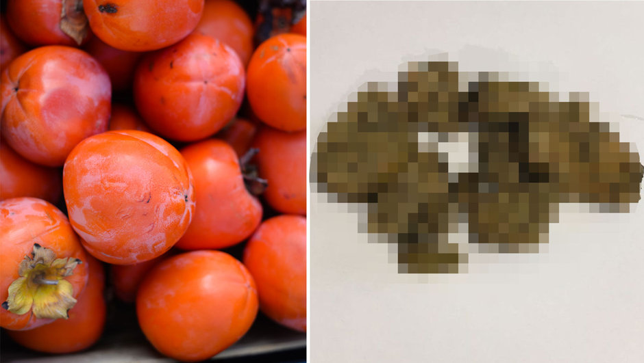 Her gün yediği meyve midesinde tenis topu büyüklüğünde kist oluşturdu!