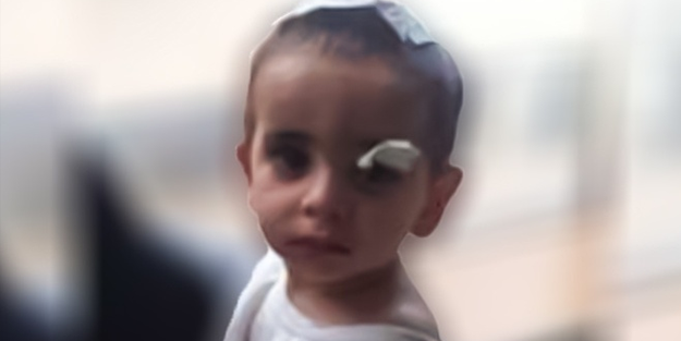 Her gün yeni bir kurban! Ağrı'da sokak köpeklerinin saldırısında bir çocuk daha öldü!