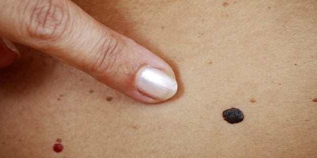  Her saat başı 1 kişi bu hastalık yüzünden hayatını kaybediyor