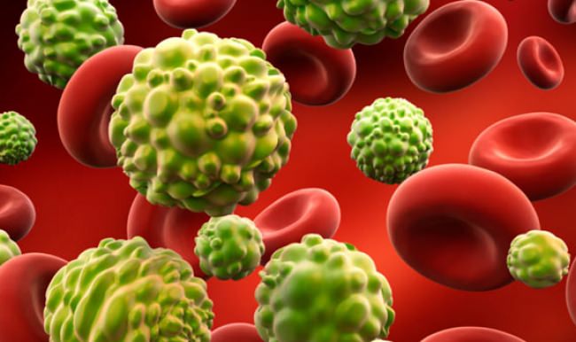 Her tiroid nodülü kanser değil