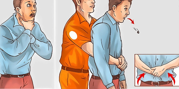 Her vatandaşın bilmesi gerekiyor! İşte hayat kurtaran Heimlich Manevrası...