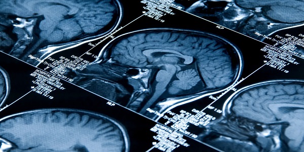 Herkes şaşkın! İlk kez beyin bedenden bağımsız canlı kaldı ama...