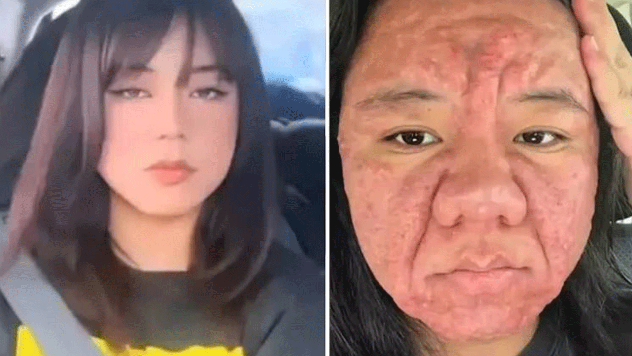 Herkes şok oldu: 28 yaşındaki kadın 1 ayda 30 yıl yaşlandı