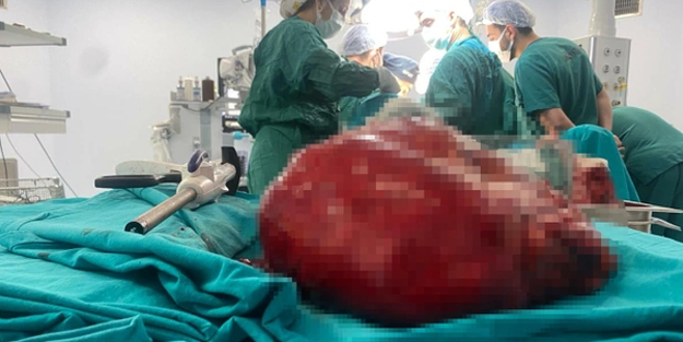 Herkes şokta: Böbrek ağrısıyla doktora gitti karnından öyle bir şey çıktı ki!