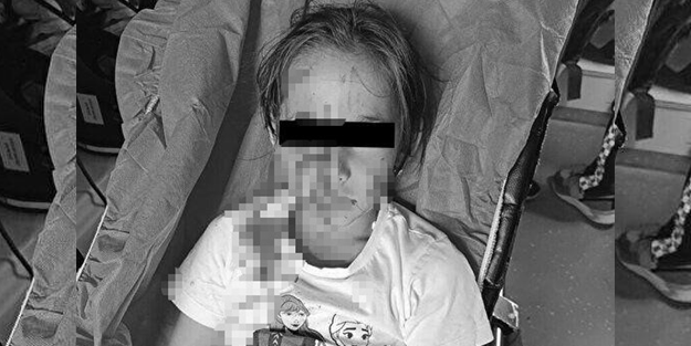 Hesap soran da yok hesap veren de... Başıboş köpek dehşeti