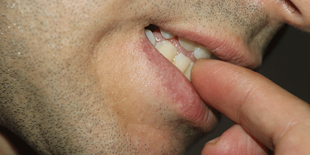 Hiç kimsenin aklına bile gelmez! Tırnak yeme alışkanlığının sebebi bakın neymiş