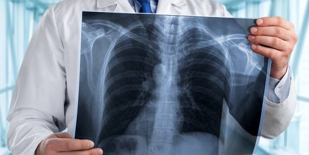 Hiç utanmaları yok! Muhalif medyanın 'veremle mücadele' yalanı...