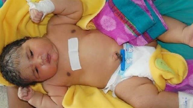 Hindistan'da 60 cm boyunda 6.8 kiloluk bebek
