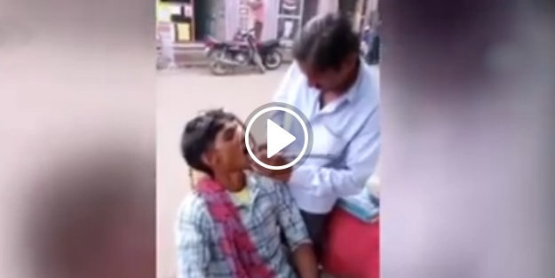 Hint usulü sıra dışı diş tedavisi