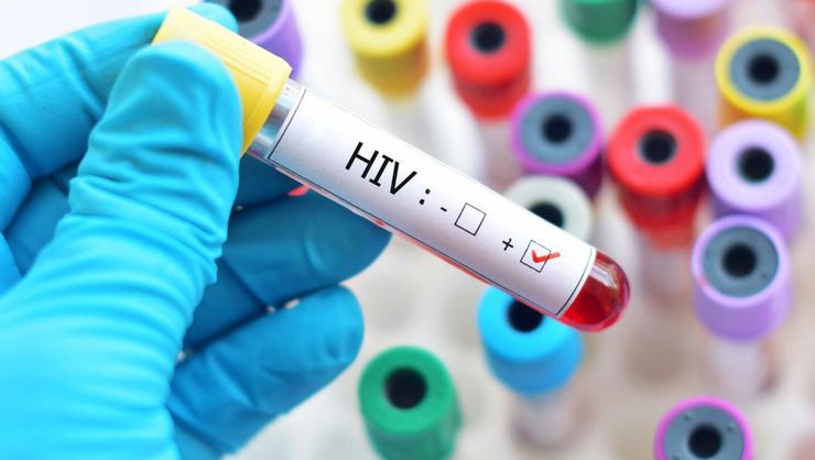 HIV taşıyanların yüzde 75'i durumundan haberdar